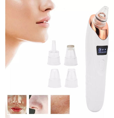 Removedor de puntos negros QDS by Importadora Elizalde SpA