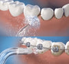 Irrigador Bucal Recargable Portátil 4 en 1 QDS by Importadora Elizalde SpA
