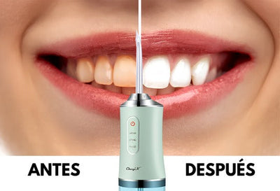 Irrigador Bucal Recargable Portátil 4 en 1 QDS by Importadora Elizalde SpA